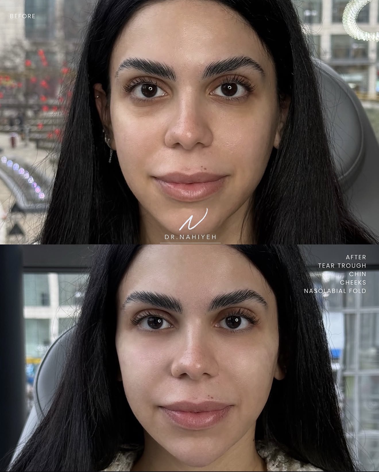Full-Face Refinement — image 3