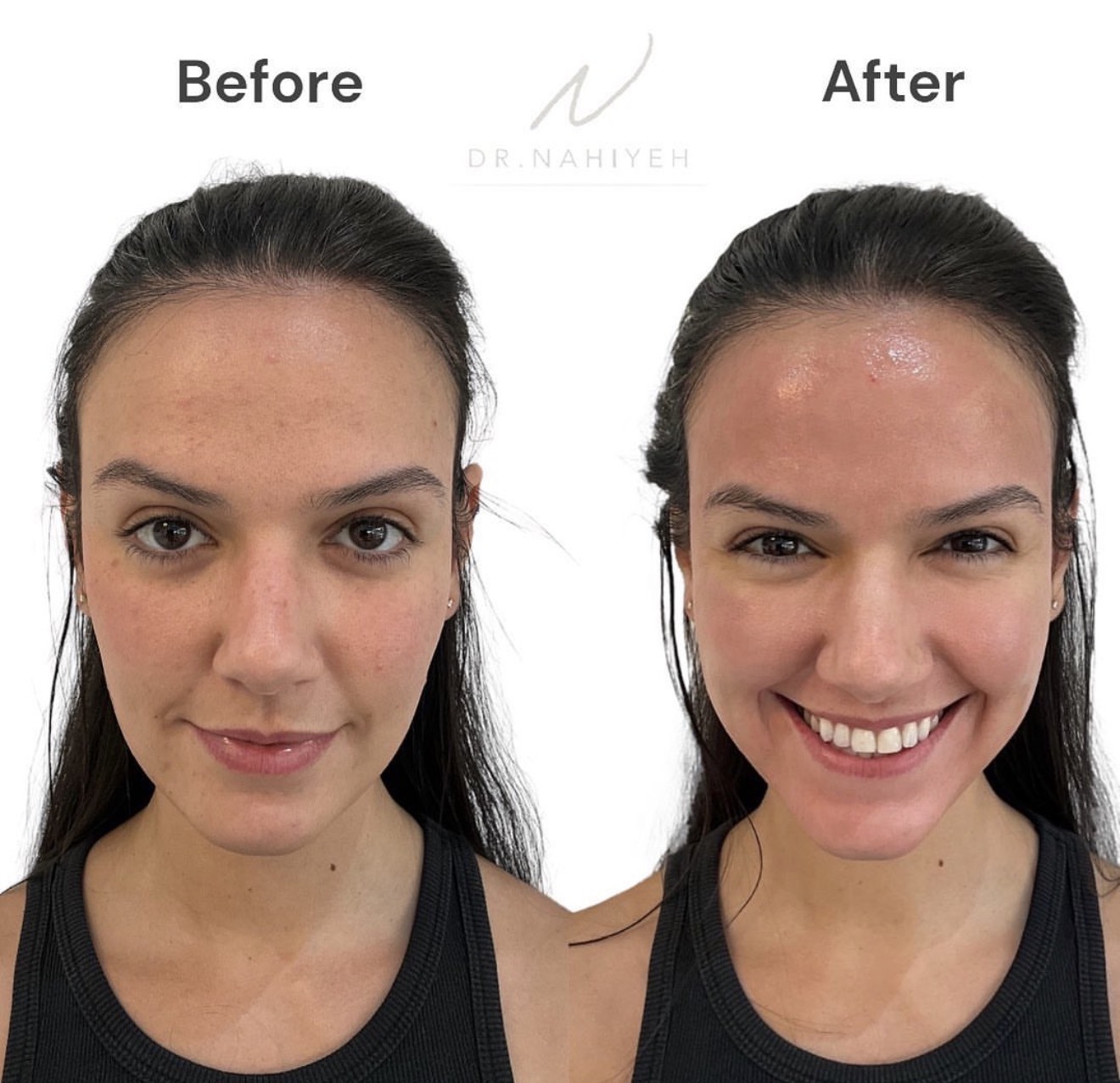 Medical-Grade Skin Treatment — image 1
