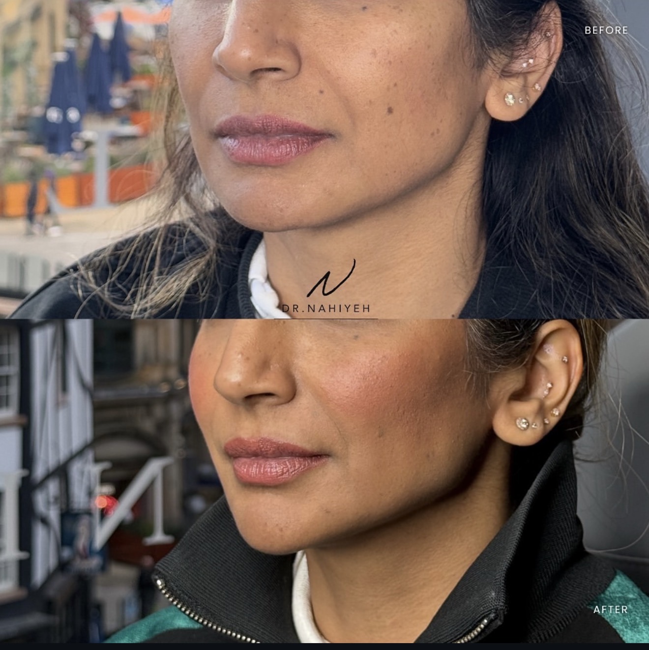 Facial Balancing — Top-Up Results — image 3