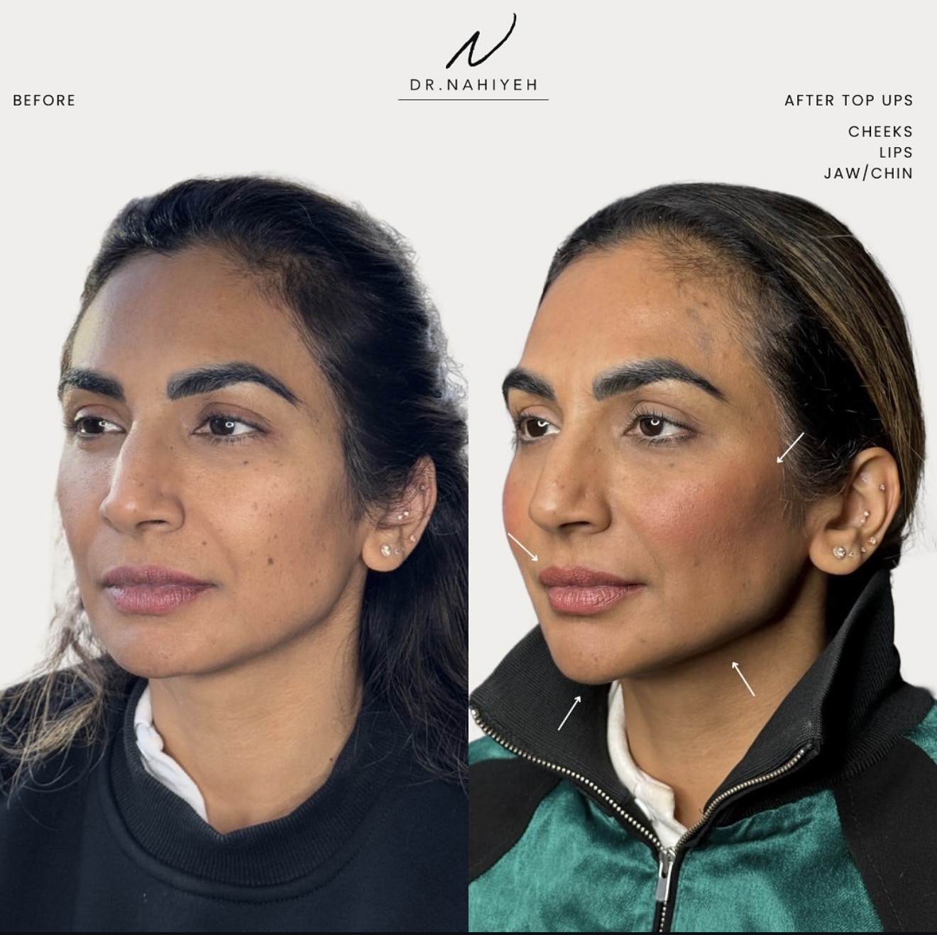 Facial Balancing — Top-Up Results — image 2