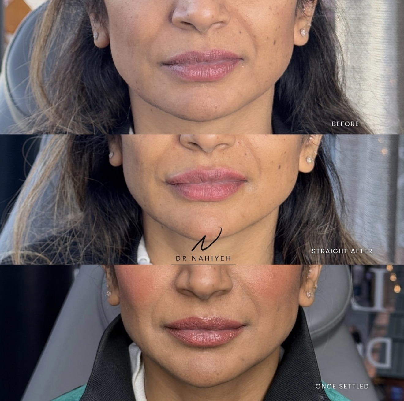 Facial Balancing — Top-Up Results — image 4